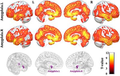 Structural Covariance of the Prefrontal-Amygdala Pathways Associated with Heart Rate Variability